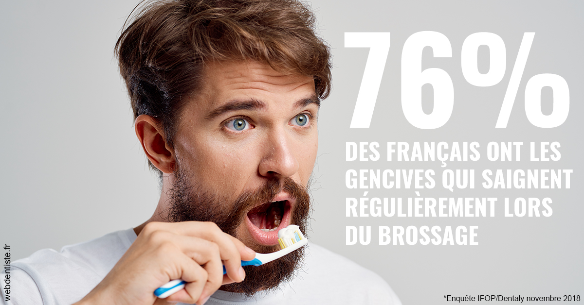 https://selarl-pascale-bonnefont.chirurgiens-dentistes.fr/76% des Français 2