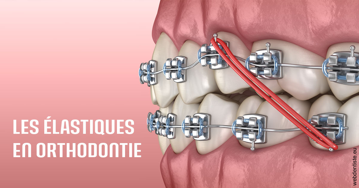 https://selarl-pascale-bonnefont.chirurgiens-dentistes.fr/Elastiques orthodontie 2