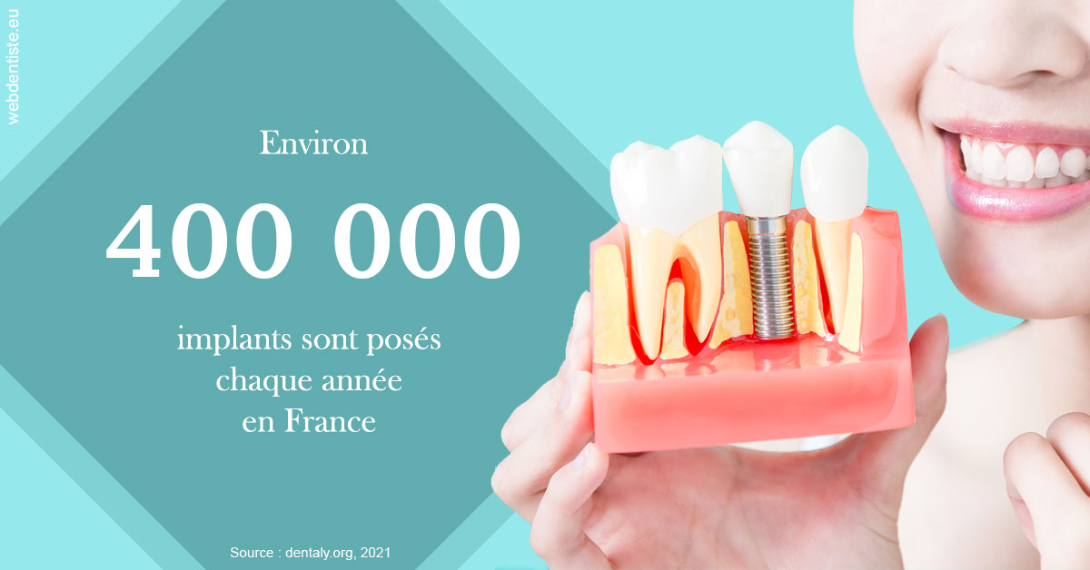 https://selarl-pascale-bonnefont.chirurgiens-dentistes.fr/Pose d'implants en France 2